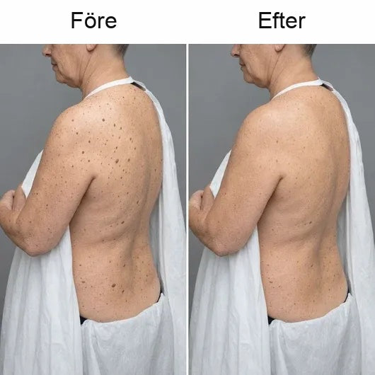 Cazoly Glykolsyra Exfolierande Body Stick