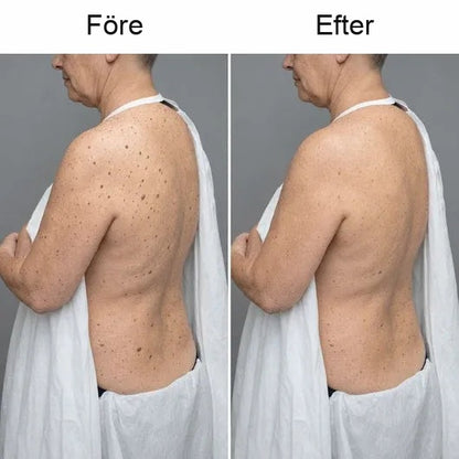 Cazoly Glykolsyra Exfolierande Body Stick