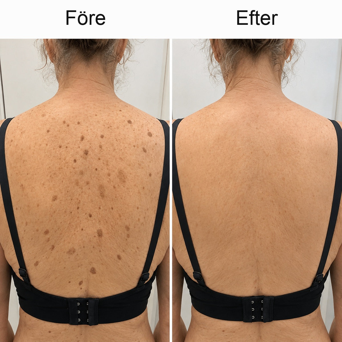 Cazoly Glykolsyra Exfolierande Body Stick
